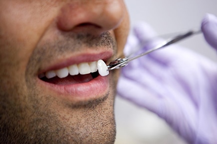 Lente dental em Ibaiti