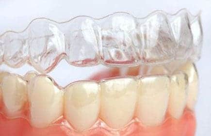 Aparelho dental Invisalign em Ibaiti